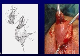 模拟手术女变男视频